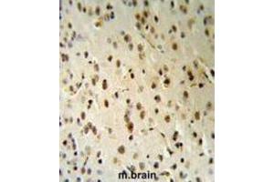 Immunohistochemistry (IHC) image for anti-threonyl-tRNA Synthetase-Like 2 (TARSL2) antibody (ABIN3003853) (TARSL2 antibody)