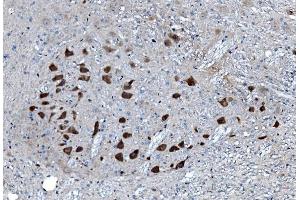 IHC analysis of MAP3K8 using anti-MAP3K8 antibody (ABIN4886663). (MAP3K8 antibody  (AA 9-193))
