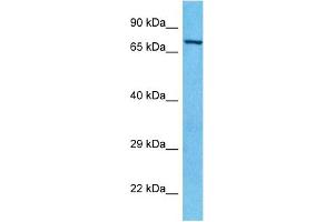 Host:  Rabbit  Target Name:  PAK6  Sample Type:  HepG2 Whole Cell lysates  Antibody Dilution:  1. (PAK6 antibody  (C-Term))