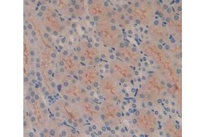 Immunohistochemistry (IHC) image for anti-Mars (MARS) (AA 74-212) antibody (ABIN5013931)