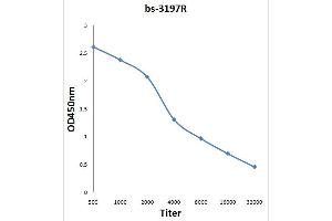 Antigen: 0. (IRS1 antibody  (pSer1101))