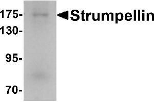 Western blot analysis of Strumpellin in human ovary tissue lysate with Strumpellin antibody at 1 µg/mL. (Strumpellin antibody  (C-Term))