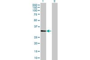 Western Blot analysis of CDV3 expression in transfected 293T cell line by CDV3 MaxPab polyclonal antibody. (CDV3 antibody  (AA 1-213))