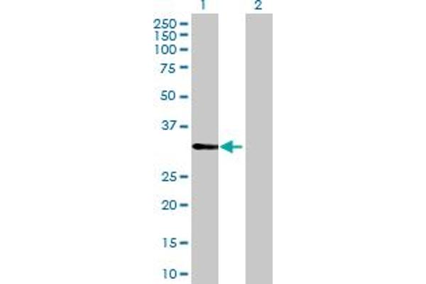 CDV3 antibody  (AA 1-213)