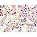 anti-Mitogen-Activated Protein Kinase Kinase 2 (MAP2K2) (AA 1-50) antibody
