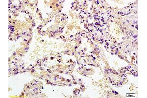 Immunohistochemistry (IHC) image for anti-Mitogen-Activated Protein Kinase Kinase 2 (MAP2K2) (AA 1-50) antibody (ABIN726500)