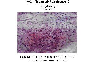 Image no. 2 for anti-Transglutaminase 2 (C Polypeptide, Protein-Glutamine-gamma-Glutamyltransferase) (TGM2) antibody (ABIN346957) (Transglutaminase 2 antibody)