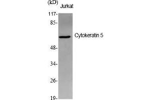 Western Blot analysis of various cells using Cytokeratin 5 Polyclonal Antibody diluted at 1:1000. (Cytokeratin 5 antibody  (AA 510-590))