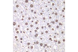 Immunohistochemistry of paraffin-embedded mouse liver using TOP1 antibody. (Topoisomerase I antibody  (AA 1-100))