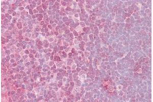 Anti-CRKL antibody IHC staining of human thymus. (CrkL antibody  (AA 292-303))