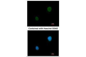 ICC/IF Image Immunofluorescence analysis of methanol-fixed HeLa, using PKA 2 beta, antibody at 1:200 dilution. (PKA 2 beta (Center) antibody)