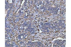 IHC analysis of HLA-DRA using anti-HLA-DRA antibody (ABIN7600948). (HLA-DRA antibody  (AA 26-254))