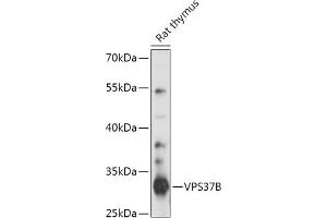 Western blot analysis of extracts of Rat thymus, using VPS37B antibody (ABIN7271278) at 1:1000 dilution. (VPS37B antibody  (AA 60-170))