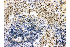 Anti- CTBP1 Picoband antibody, IHC(P) IHC(P): Rat Spleen Tissue (CTBP1 antibody  (C-Term))