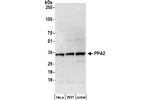 anti-Pyrophosphatase 2 (PPA2) (AA 25-75) antibody