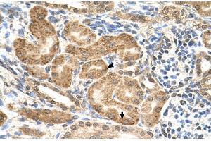 Human kidney (GMPPB antibody  (C-Term))