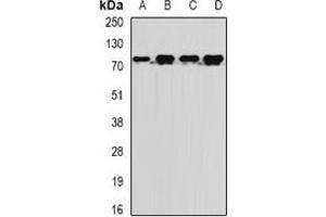 Western blot analysis of MTMR14 expression in BT474 (A), Jurkat (B), mouse liver (C), rat brain (D) whole cell lysates.