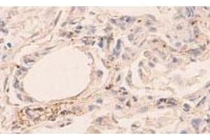 Immunohistochemical staining of formalin-fixed paraffin-embedded human lung showing staining with ANGPT4 polyclonal antibody  at 1:100 dilution.
