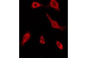 ABIN6276162 staining COLO205 by IF/ICC. (OR51A7 antibody  (C-Term))