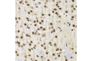 Immunohistochemistry of paraffin-embedded mouse brain using UMPS antibody (ABIN5973202) at dilution of 1/200 (40x lens). (UMPS antibody)