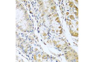 Immunohistochemistry of paraffin-embedded human stomach using RNASE13 antibody at dilution of 1:100 (40x lens). (RNASE13 antibody)