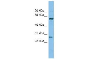Chymotrypsinogen B1 antibody used at 1 ug/ml to detect target protein. (CTRB1 antibody  (Middle Region))