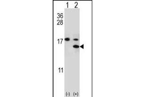 Western blot analysis of S100A11 (arrow) using rabbit polyclonal S100A11 Antibody (S6) (ABIN389308 and ABIN2839429).
