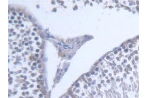 Detection of PLTP in Rat Testis Tissue using Polyclonal Antibody to Phospholipid Transfer Protein (PLTP) (PLTP antibody  (AA 337-479))