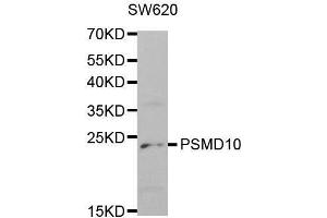 Western blot analysis of extracts of SW620 cell lines, using PSMD10 antibody. (PSMD10 antibody  (AA 1-226))
