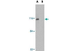 Western blot analysis of JPH3 in Daudi cell lysate with JPH3 polyclonal antibody  at 1 ug/mL in (A) the absence and (B) the presence of blocking peptide.