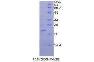 SDS-PAGE (SDS) image for Matrix Metallopeptidase 13 (Collagenase 3) (MMP13) (AA 280-455) protein (His tag) (ABIN1879762) (MMP13 Protein (AA 280-455) (His tag))