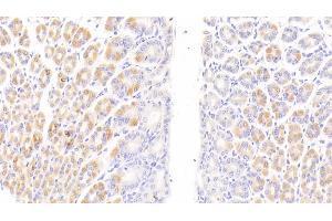 Immunohistochemistry (IHC) image for anti-CD163 (CD163) (AA 697-972) antibody (ABIN7439330)