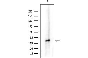 anti-Proteasome (Prosome, Macropain) Subunit, beta Type, 4 (PSMB4) (Internal Region) antibody