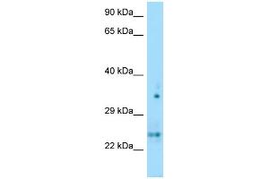 WB Suggested Anti-OLIG1 Antibody Titration: 1. (OLIG1 antibody  (N-Term))