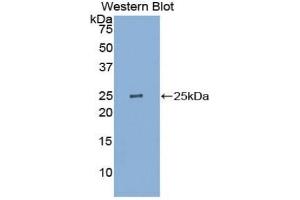 Detection of Recombinant PK, Human using Polyclonal Antibody to Pyruvate kinase isozymes R/L (PKLR) (PKLR antibody  (AA 219-420))