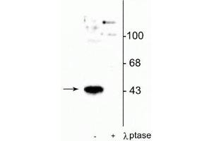 Western blot of human T47D cells showing specific immunolabeling of the ~45 kDa MEK 1 protein phosphorylated at Thr386 in the first lane (-). (MEK1 antibody  (pThr386))