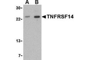 Western blot analysis of TNFRSF14 in mouse thymus tissue lysate with this product at (A) 1 and (B) 2 μg/ml. (HVEM antibody  (N-Term))