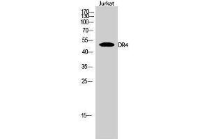 Western Blotting (WB) image for anti-Drought-Repressed 4 Protein (DR4) (C-Term) antibody (ABIN3184356) (DR4 antibody  (C-Term))