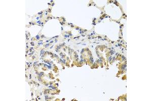 Immunohistochemistry of paraffin-embedded mouse lung using Bax antibody (ABIN5970040) at dilution of 1/100 (40x lens). (BAX antibody)