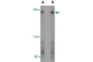 Western blot analysis of GPR124 in human bladder tissue lysate with GPR124 polyclonal antibody  at (A) 2 and (B) 4 ug/mL . (GPR124 antibody  (C-Term))