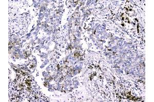 IHC analysis of Cytochrome C using anti-Cytochrome C antibody (ABIN5693008). (Cytochrome C antibody  (AA 2-105))
