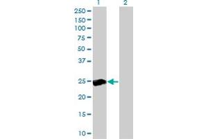 Western Blot analysis of RALB expression in transfected 293T cell line by RALB monoclonal antibody (M04), clone 4D1. (RALB antibody  (AA 89-183))