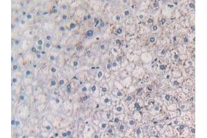 Detection of MCP1 in Human Liver Tissue using Polyclonal Antibody to Monocyte Chemotactic Protein 1 (MCP1) (CCL2 antibody  (AA 24-99))
