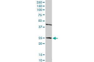 HSD17B2 MaxPab rabbit polyclonal antibody. (HSD17B2 antibody  (AA 1-387))