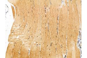 ABIN7094382 and ABIN7098429 at 1/100 staining Rat muscle tissue by IHC-P.