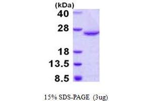 SDS-PAGE (SDS) image for Dual Specificity Phosphatase 18 (DUSP18) (AA 1-188) protein (His tag) (ABIN668030) (DUSP18 Protein (AA 1-188) (His tag))