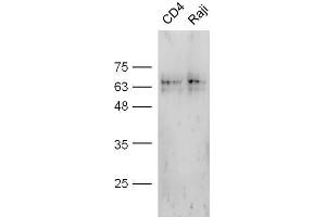 Mouse stomach probed with Anti-CD4 Polyclonal Antibody, Unconjugated  at 1:5000 for 90 min at 37˚C. (CD4 antibody  (AA 301-400))