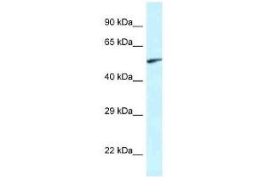 Western Blot showing Eya2 antibody used at a concentration of 1. (EYA2 antibody  (Middle Region))