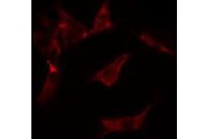 ABIN6275591 staining  Hela cells by IF/ICC. (ATP1A2 antibody  (N-Term))