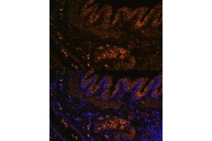 Immunofluorescence analysis of rat lung using MMP9 antibody (ABIN3022899, ABIN3022900, ABIN3022901, ABIN1513215 and ABIN6219286) at dilution of 1:100. (MMP 9 antibody  (AA 538-707))